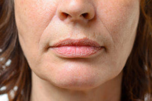 Wrinkle Treatment in Orlando, FL