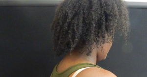Plastic Surgery Before and After Pictures in Orlando, FL
